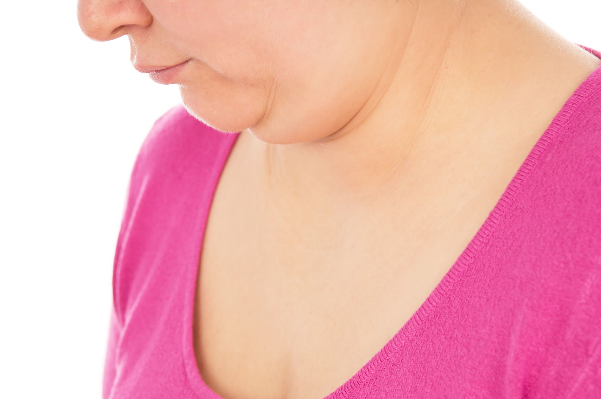 Treating a Double Chin With CoolSculpting or Kybella